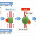腱鞘炎